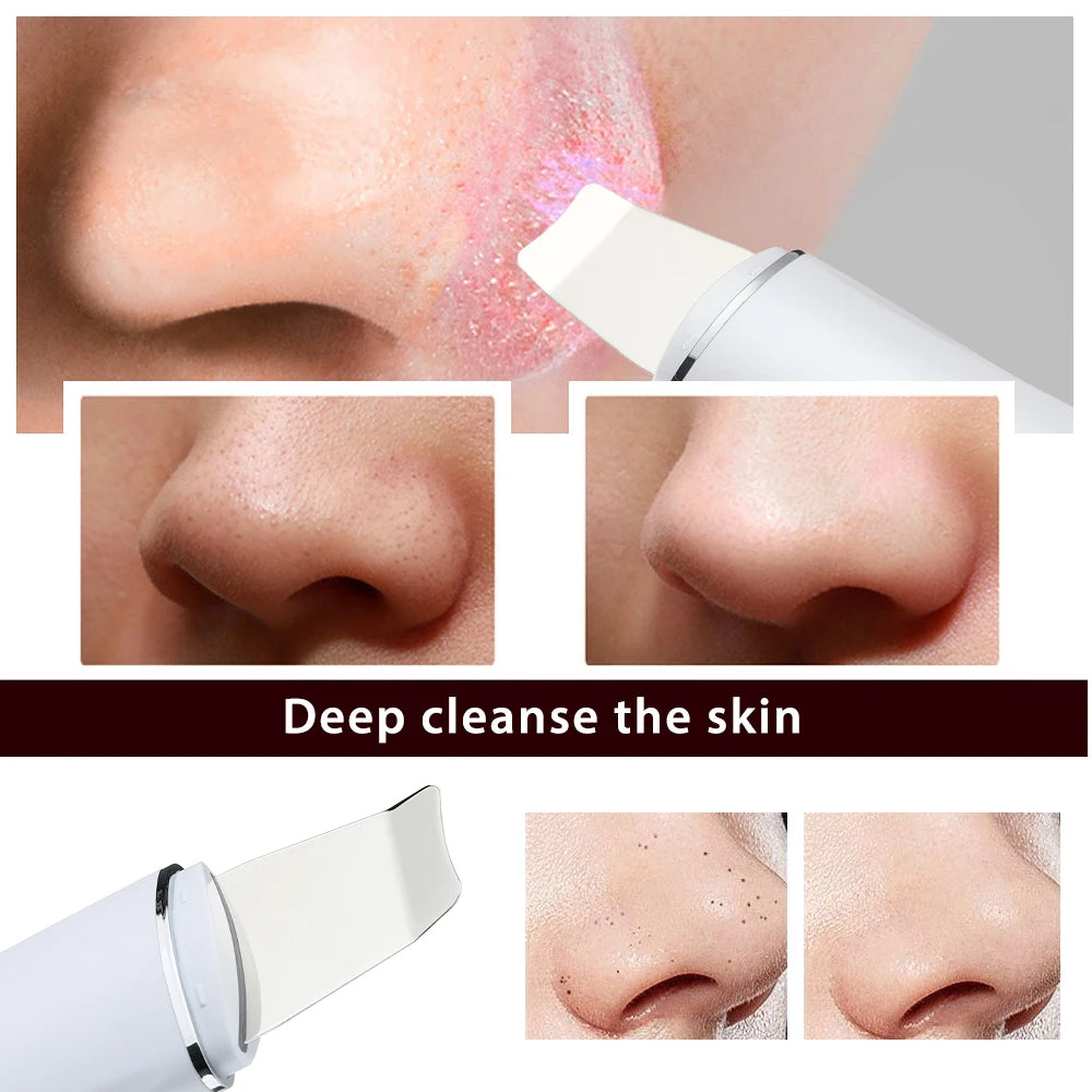 SKINWAVE™ Ultrasonic Pore Cleanser